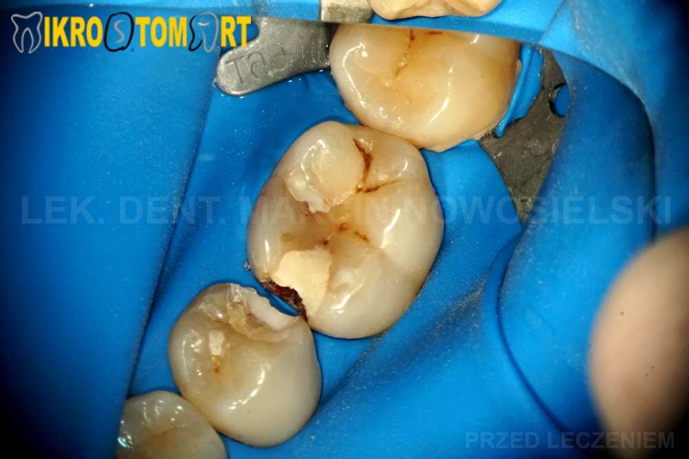 Stomatologia estetyczna