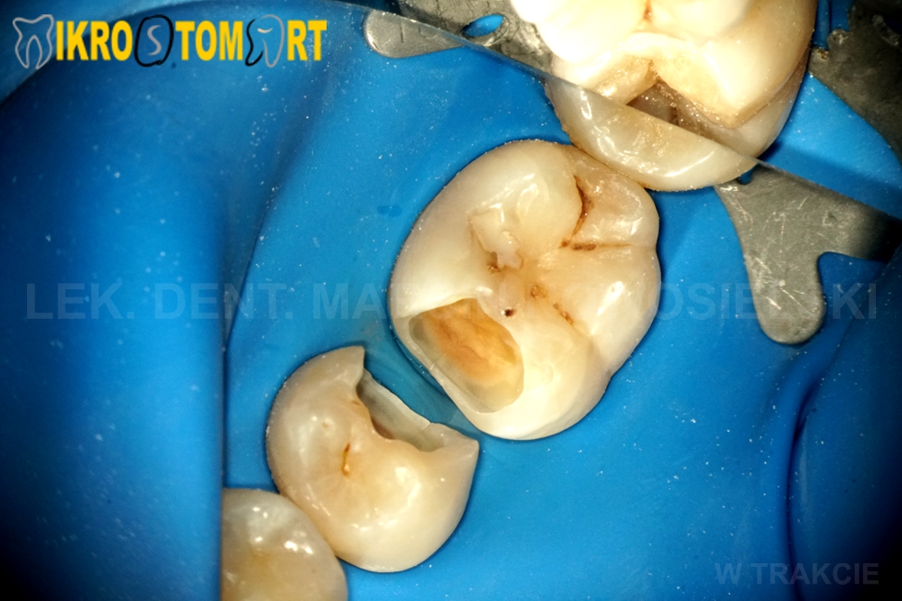 Stomatologia estetyczna